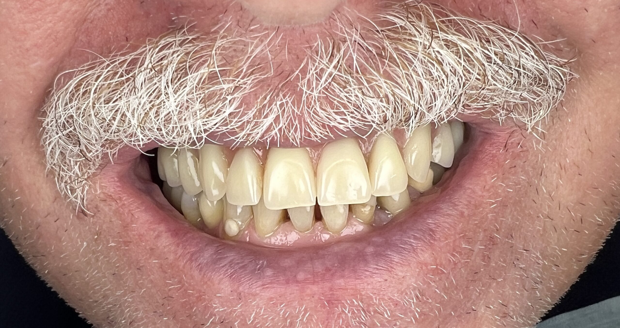 Dopo